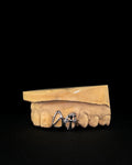 Grillz 2 piezas Diseño Personalizado Cromo