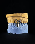 Grillz 3 piezas Cromo